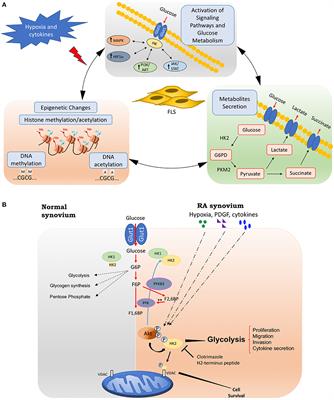 Fibroblast-Like Synoviocytes Glucose Metabolism as a Therapeutic Target in Rheumatoid Arthritis